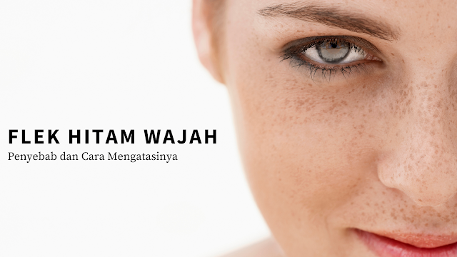 cream penghilang flek hitam, flek hitam, krim penghilang flek hitam, serum penghilang flek hitam, cara mencegah flek hitam, cara atasi flek hitam cream penghilang flek hitam