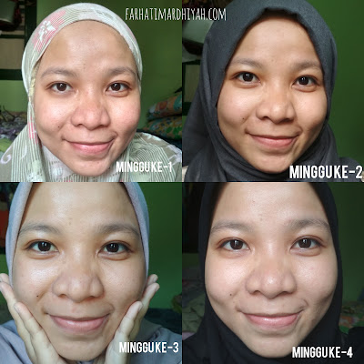 Avoskin Miraculous Refining Serum Review Avoskin Miraculous Refining Serum, Review Skincare, Review Exfoliator serum, Exfoliator rekomendasi untuk kulit berjerawat, Exfoliator untuk kulit berminyak, Exfoliator untuk oily skin, Tips memilih exfoliator, kandungan exfoliator yang aman, exfoliator acne prone skin, exfoliator oily skin, exfoliator untuk kulit berminyak dan berjerawat, niacinamide untuk jerawat, ceramide untuk apa, ceramide untuk kulit lembab, kandungan AHA BHA, niacinamide dalam exfoliator
