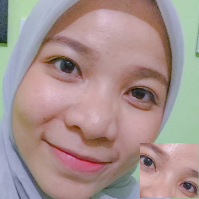Review Softlense Acuvue Vita Softlense terbaik di Indonesia, Softlense aman, Softlense bagus, softlense rekomended, memilih softlense yang aman, cara memasang softlense, keunggulan softlense acuvue vita, cara memilih softlense yang baik dan aman