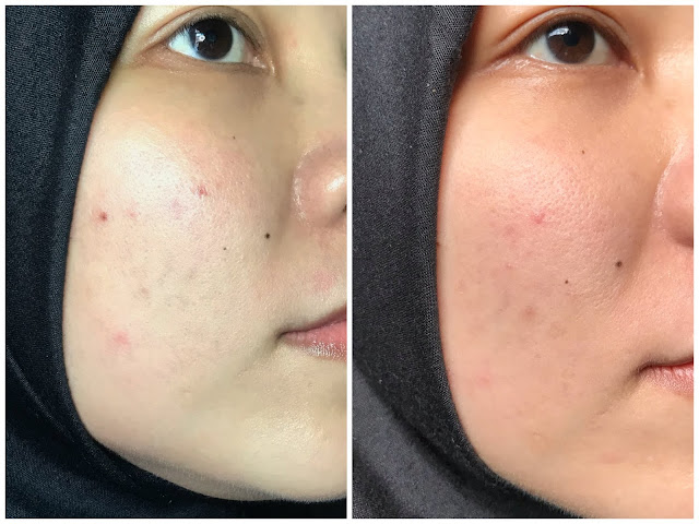 review elsheskin radiant skin serum, packaging elsheskin, tekstur serum elsheskin, elsheskin radiant skin serum, review elsheskin radiant skin serum, review elsheskin, review elsheskin radiant serum, review serum elsheskin, review elsheskin, serum untuk kulit kering, serum untuk kulit kusam, serum pencerah kulit wajah, review serum pencerah kulit wajah review elsheskin radiant skin serum