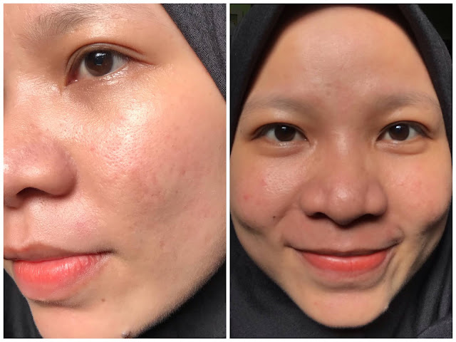 packaging elsheskin, tekstur serum elsheskin, elsheskin radiant skin serum, review elsheskin radiant skin serum, review elsheskin, review elsheskin radiant serum, review serum elsheskin, review elsheskin, serum untuk kulit kering, serum untuk kulit kusam, serum pencerah kulit wajah, review serum pencerah kulit wajah elsheskin radiant skin serum